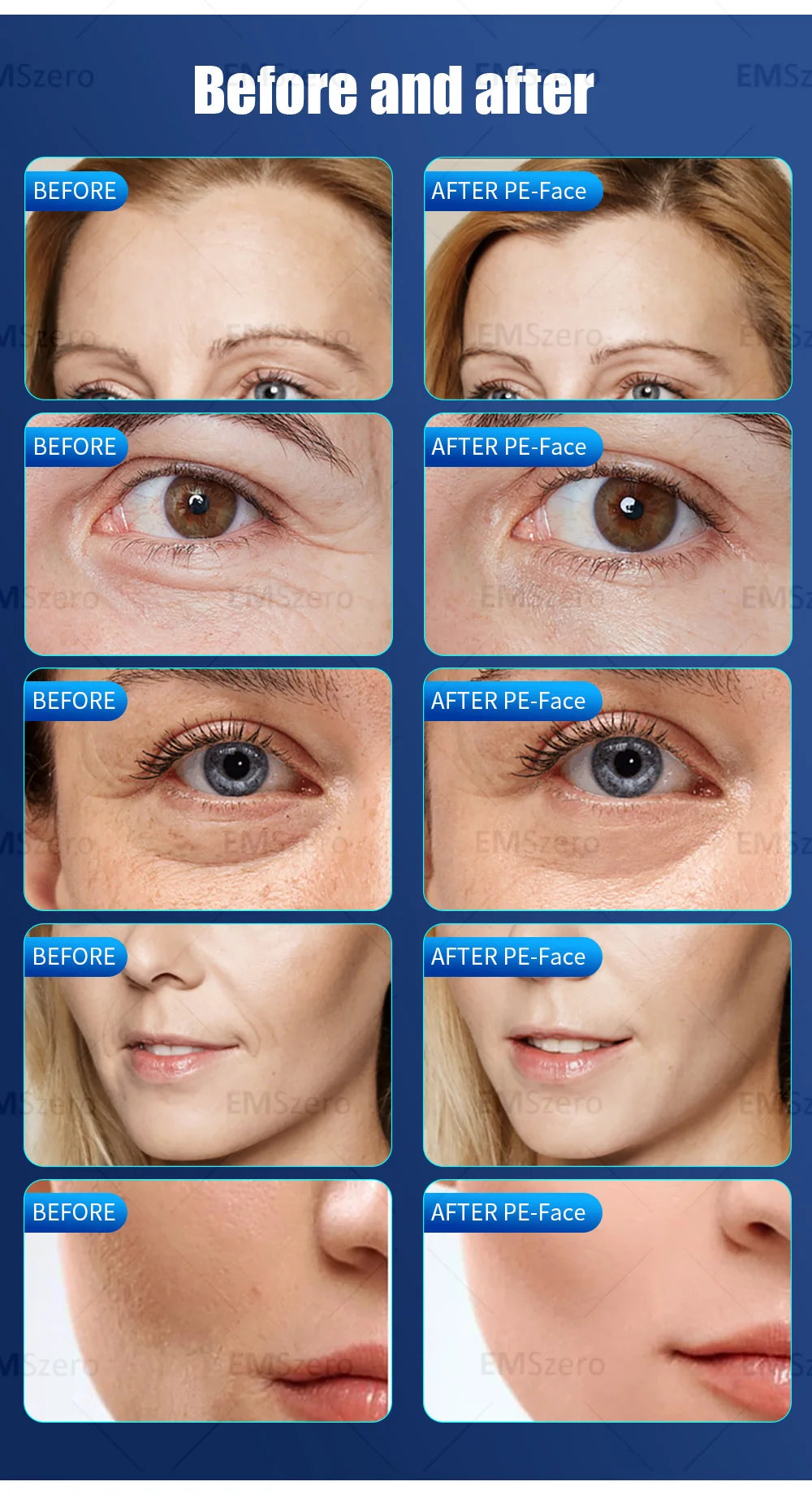 2024 The latest portable EMRF face anti-aging care machine pe face lift machine EMS face beauty machine