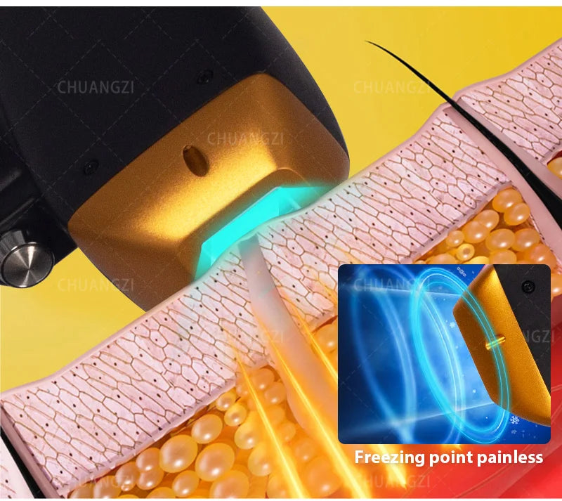 Professional Diode Ice Titanium Laser Body Hair Removal Machine 3 Wavelength 755/808/1064nm Face Hair Remove for Salon Epilator