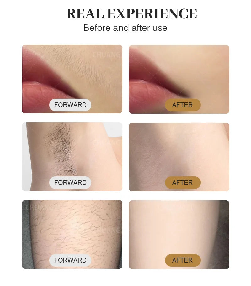 Professional Diode Ice Titanium Laser Body Hair Removal Machine 3 Wavelength 755/808/1064nm Face Hair Remove for Salon Epilator